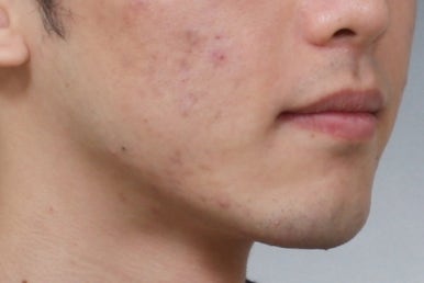 부산주걱턱교정