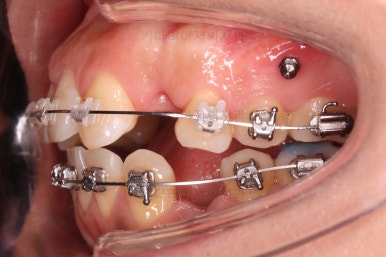 연산동교정치과