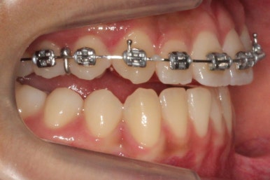 부산연산동청소년교정