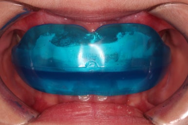 부산어린이교정