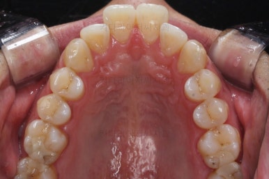 부산교정치과추천