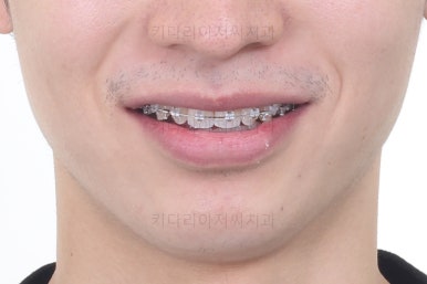 부산연제구교정