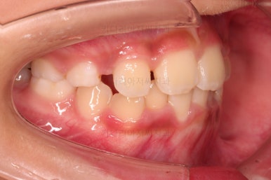 부산어린이교정