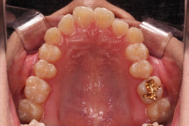 연산동치아교정치과