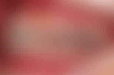 부산비발치교정