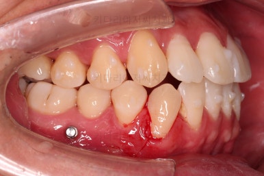 부산인비절라인