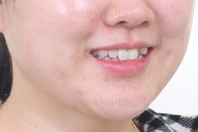 부산인비절라인