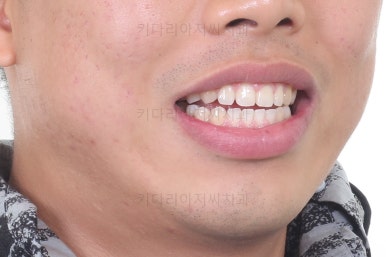 부산교정치과