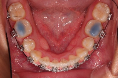 연산동치아교정치과