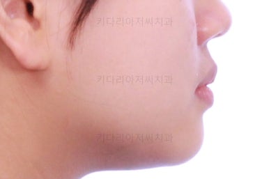 부산교정전문의