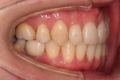 부산재교정치과