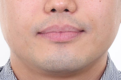 부산교정치과추천