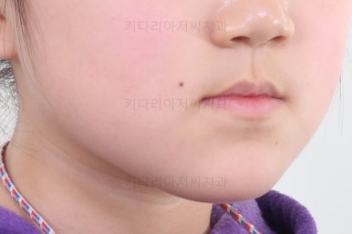 부산초등학생교정