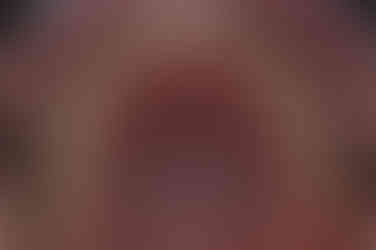 부산주걱턱교정