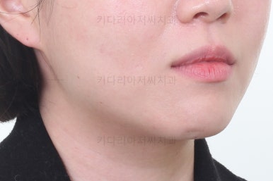 부산치아교정잘하는곳