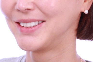 연산동부분교정