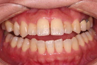 부산연산동치과