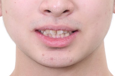 부산교정치과추천