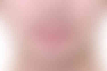 부산교정치과추천