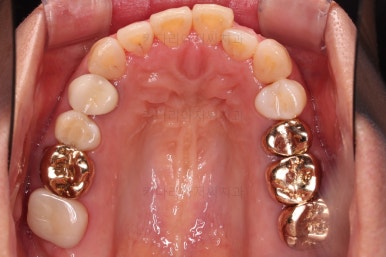 연산동부분교정