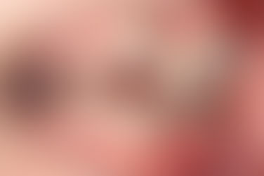 부산덧니교정