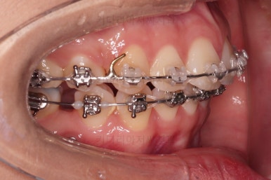 연산동치아교정치과