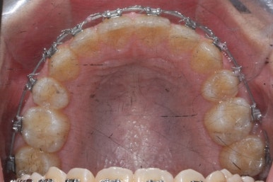 부산교정전문의