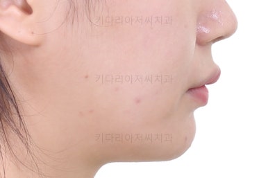 연산동교정치과