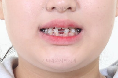 부산교정치과추천