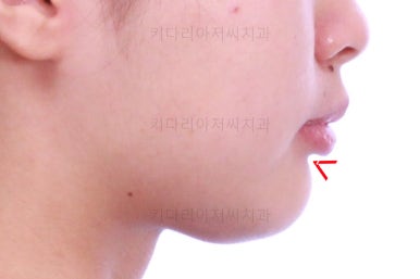 부산치아교정치과