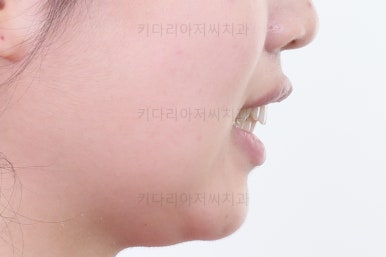 부산이빨교정