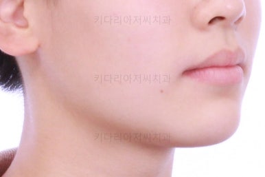 부산연산동치아교정