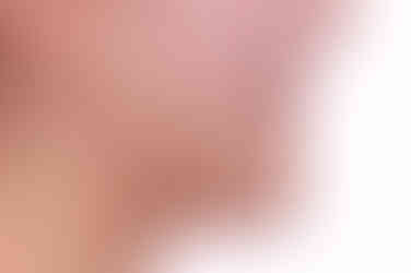 부산치아교정