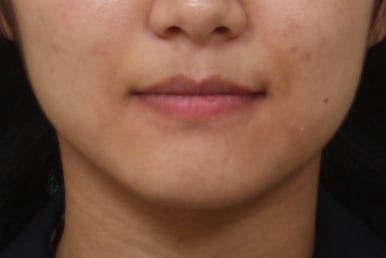 부산연산동청소년교정