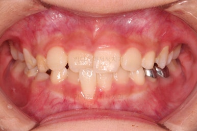 부산어린이교정
