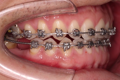 연산동임플란트