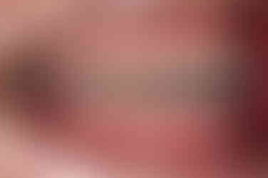 연산동임플란트