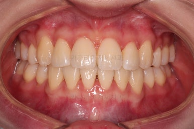 부산교정전문의
