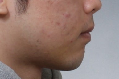 부산주걱턱교정