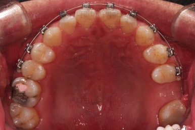 연산동임플란트