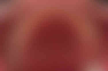 연산동임플란트