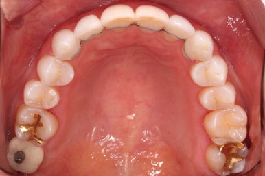 연산동부분교정