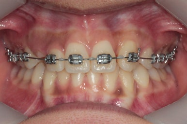 부산연산동청소년교정