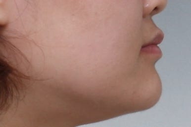 부산치아교정치과