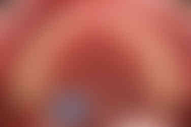 부산어린이치아교정