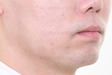 부산교정치과