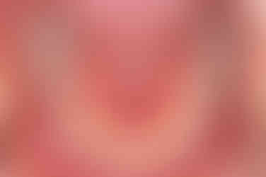 부산연산동교정치과