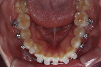 연산동교정치과