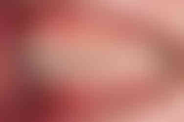 부산부분치아교정