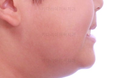 부산어린이교정